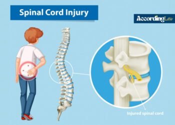 How to Maximize Your Claim in a Spinal Cord Injury
